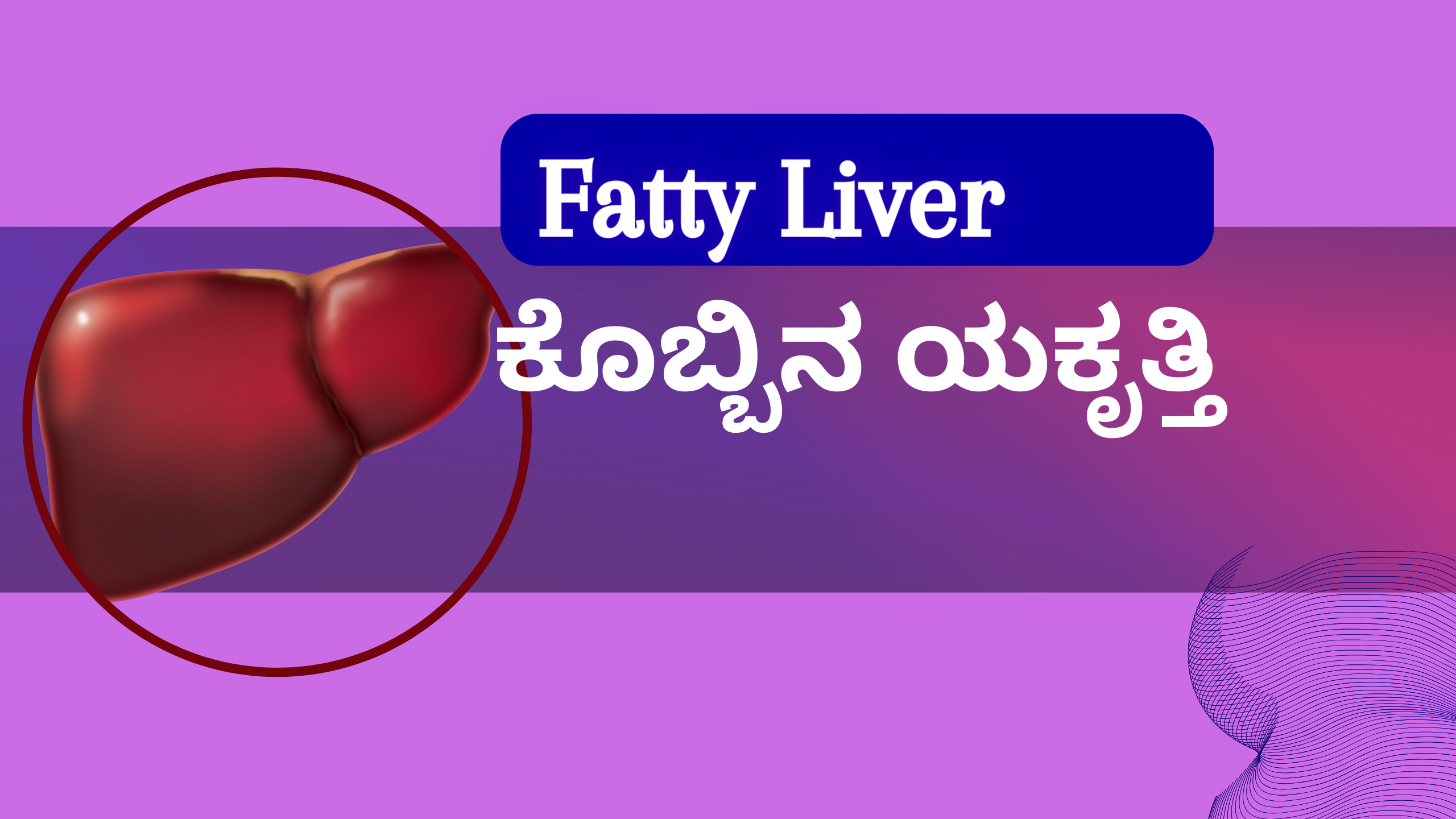 fatty liver